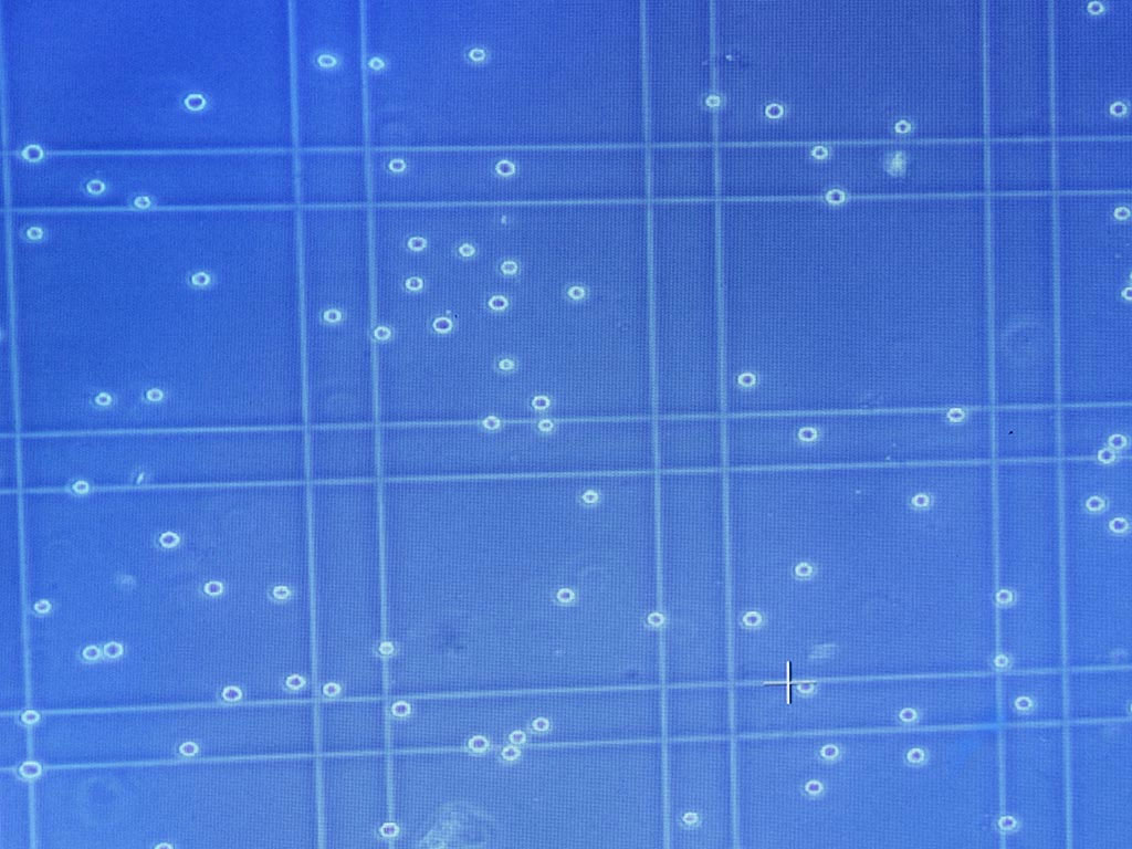 Accurate Cell Counting Using A Hemocytometer Lonza 