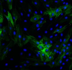 Diseased Bronch. Sm. Muscle Cells (COPD)