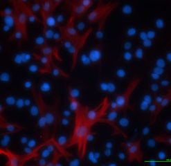 Diseased Bronchial Smooth Muscle-Asthma