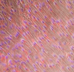 NHLF-Lung Fibroblasts FGM-2, cryo amp