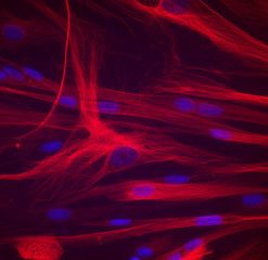 HSMM – Human Skeletal Muscle Myoblasts