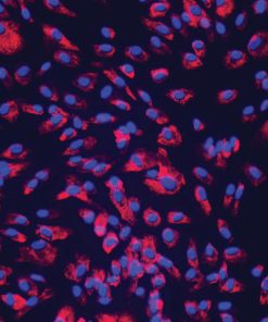 NHCF-V – Human Ventricular Cardiac Fibroblasts