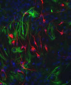 Rat Brain Hypothalamus Neurons