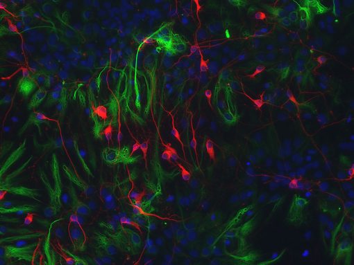 Rat Brain Hypothalamus Neurons