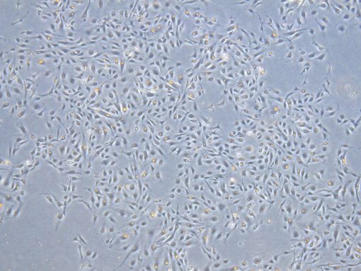 hAoVEC - Human Aortic Valve Endothelial Cells